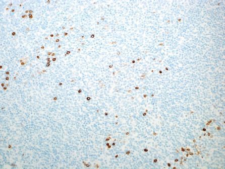 Myeloperoxidase